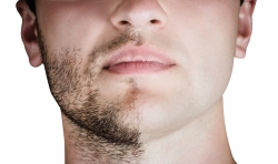 Мужская эпиляция бороды